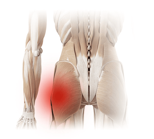 Ice packs for Hip pain